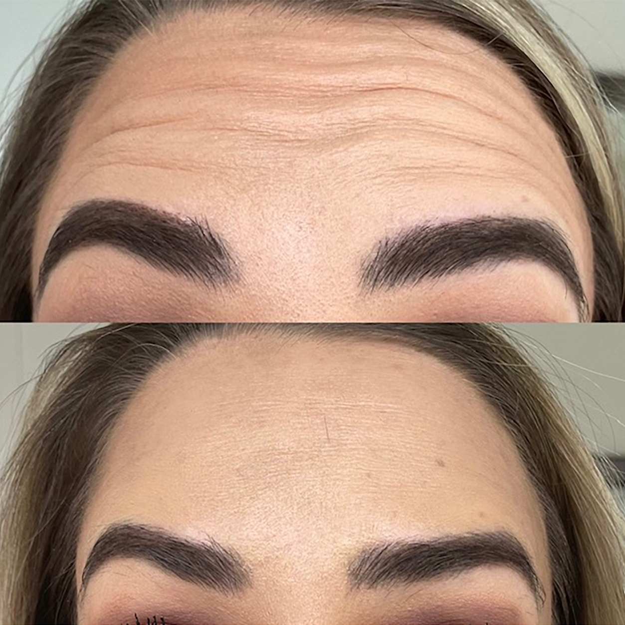 East Shore Medspa The Woodlands TX Before and After Brows